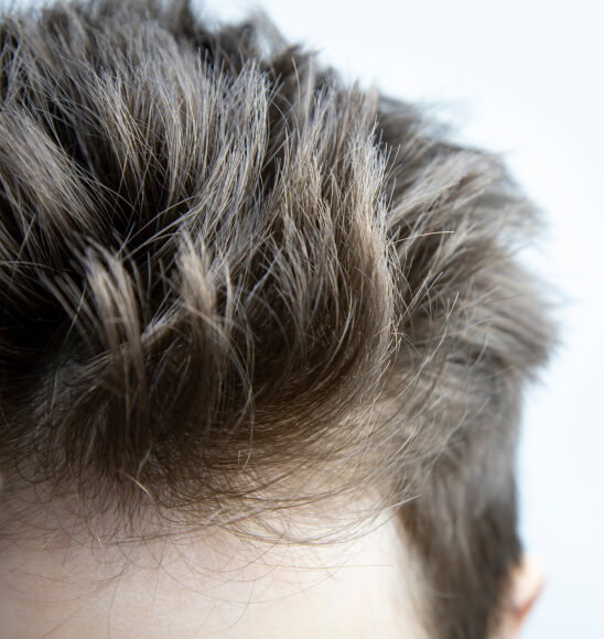 Hair